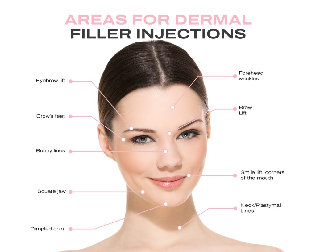 Dermal filler